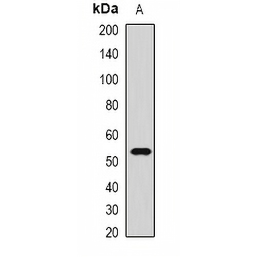CMG2 Rabbit Polyclonal Antibody