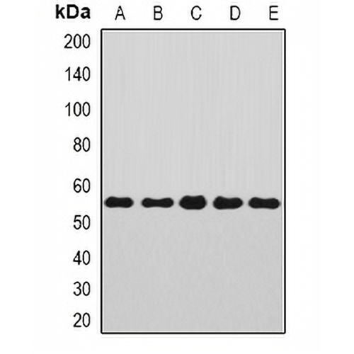 Annexin A11 Rabbit Polyclonal Antibody