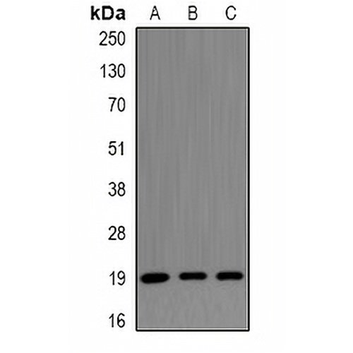 CENPS Rabbit Polyclonal Antibody