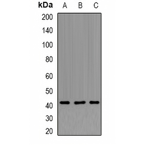 APTX Rabbit Polyclonal Antibody