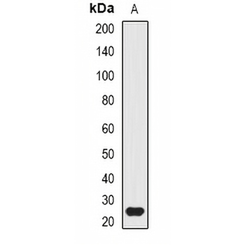 ATG10 Rabbit Polyclonal Antibody
