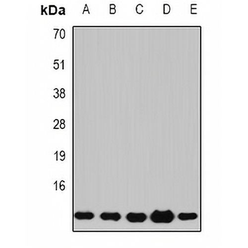 Beta 2 Microglobulin Rabbit Polyclonal Antibody