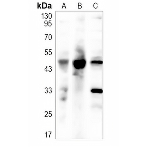 BMP15 Rabbit Polyclonal Antibody
