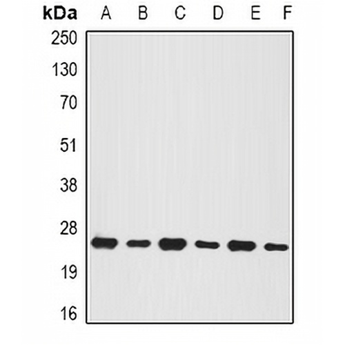 BNIP1 Rabbit Polyclonal Antibody