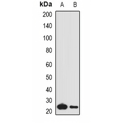 Complement C1QA Rabbit Polyclonal Antibody