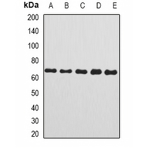 Complement C8 beta Rabbit Polyclonal Antibody