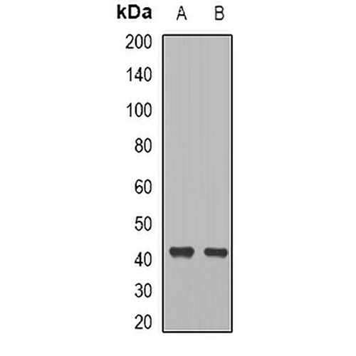 CCR8 Rabbit Polyclonal Antibody