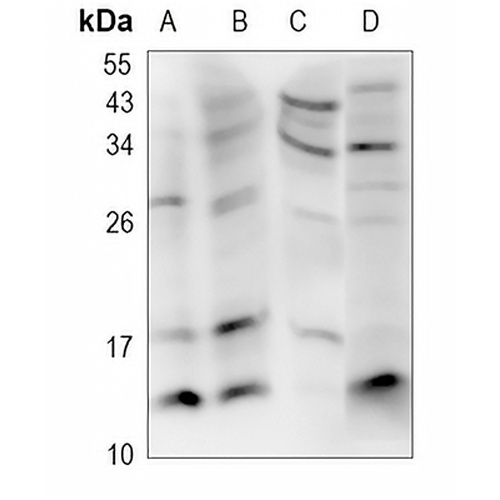 CD59 Rabbit Polyclonal Antibody