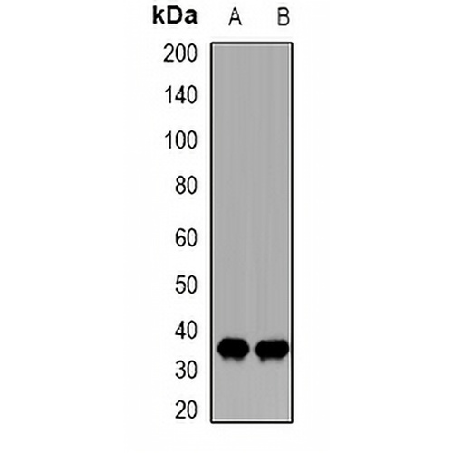 CDK20 Rabbit Polyclonal Antibody