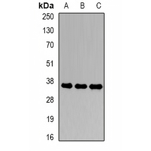 CDK6 Rabbit Polyclonal Antibody
