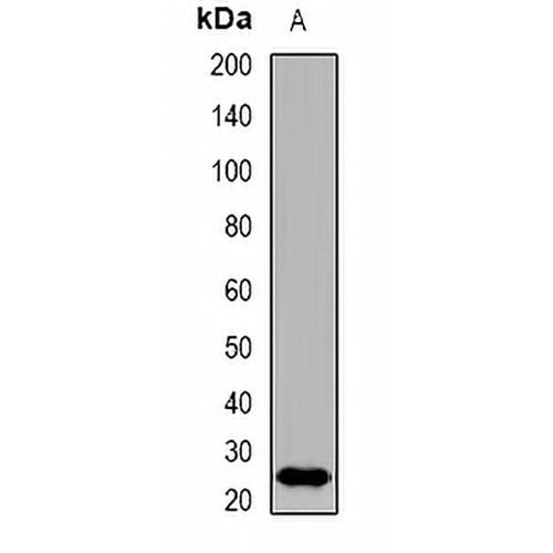 CDKN3 Rabbit Polyclonal Antibody