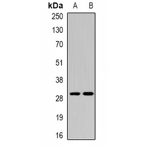 CEACAM7 Rabbit Polyclonal Antibody