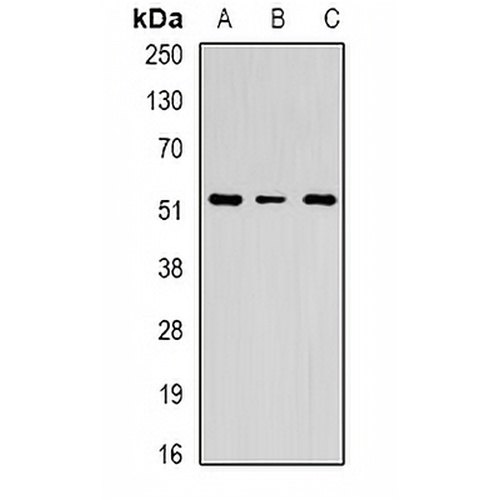 Chitotriosidase Rabbit Polyclonal Antibody
