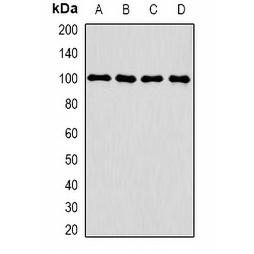 CLCN5 Rabbit Polyclonal Antibody