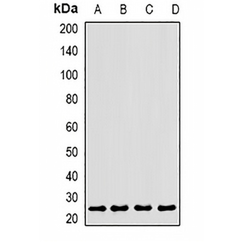 CLEC12A Rabbit Polyclonal Antibody