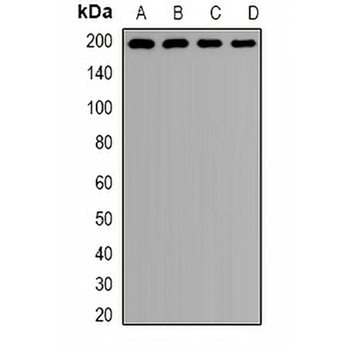 Clathrin Heavy Chain Rabbit Polyclonal Antibody