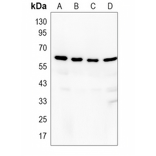 CNDP1 Rabbit Polyclonal Antibody
