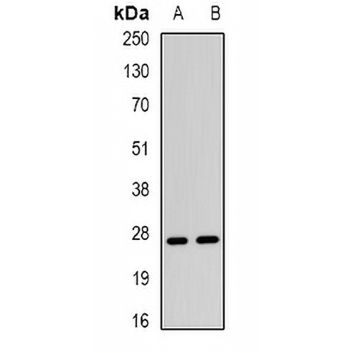 TSP1 Rabbit Polyclonal Antibody