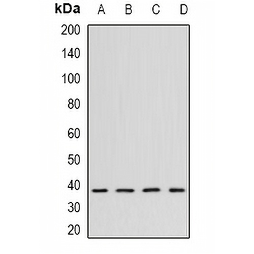 CK2 alpha Rabbit Polyclonal Antibody