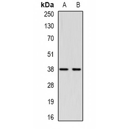 CTGF Rabbit Polyclonal Antibody