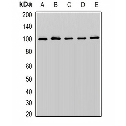 Cullin 5 Rabbit Polyclonal Antibody