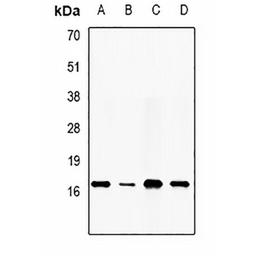 DAP Rabbit Polyclonal Antibody