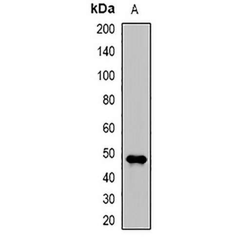 DDB2 Rabbit Polyclonal Antibody