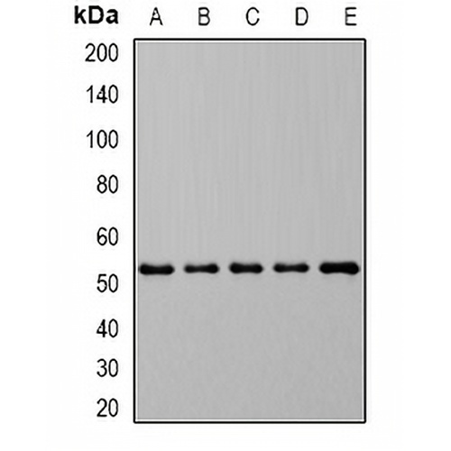 DHODH Rabbit Polyclonal Antibody