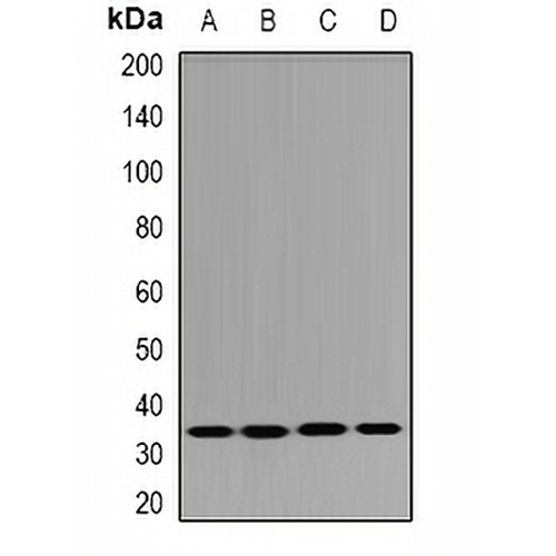 DHRS9 Rabbit Polyclonal Antibody