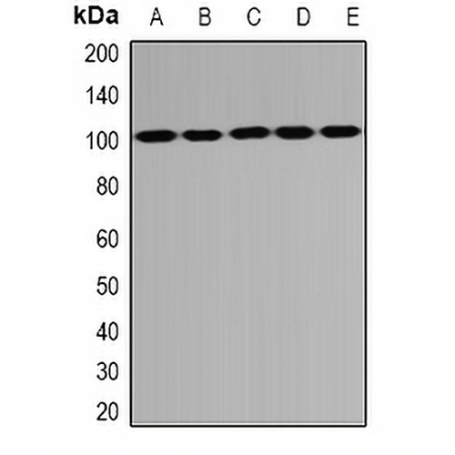 PSD95 Rabbit Polyclonal Antibody