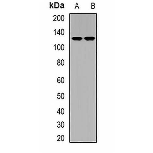 DLGAP5 Rabbit Polyclonal Antibody