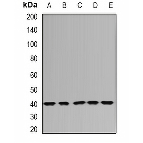 DNAJB6 Rabbit Polyclonal Antibody