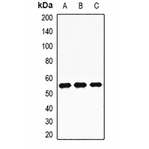 TdT Rabbit Polyclonal Antibody