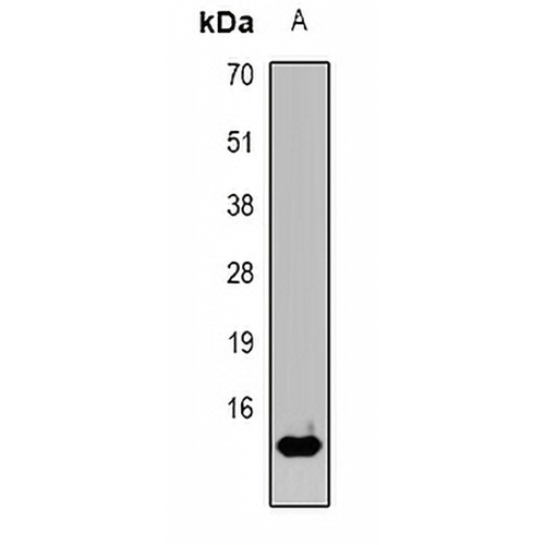 H-FABP Rabbit Polyclonal Antibody