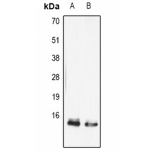 FABP5 Rabbit Polyclonal Antibody