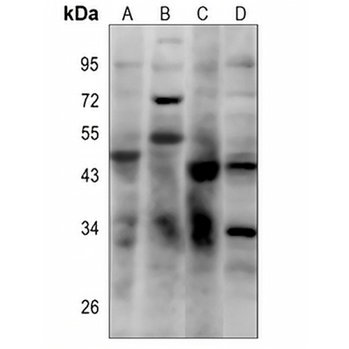 CD16b Rabbit Polyclonal Antibody