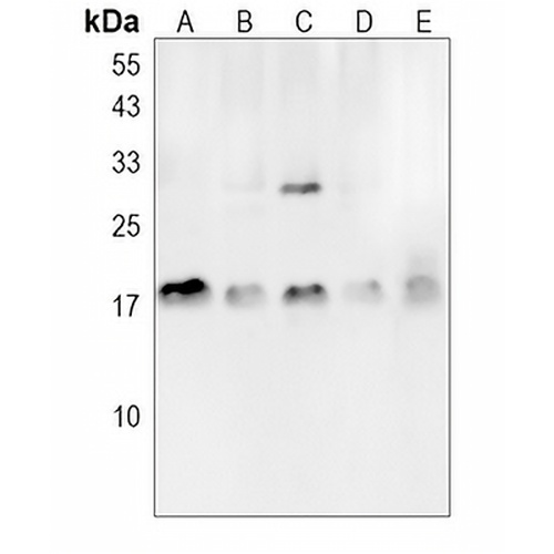 FGFBP1 Rabbit Polyclonal Antibody