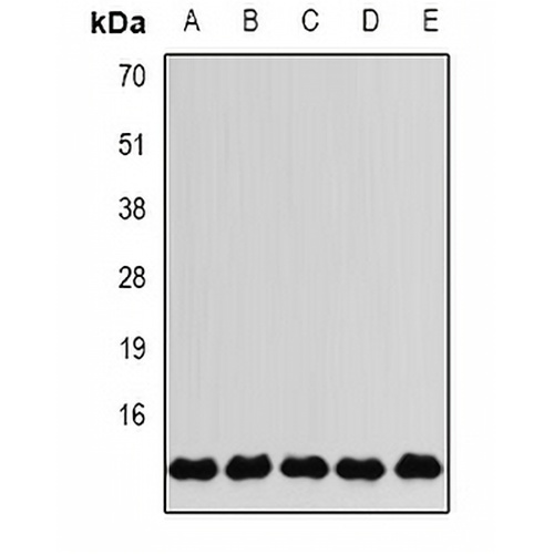 FKBP2 Rabbit Polyclonal Antibody