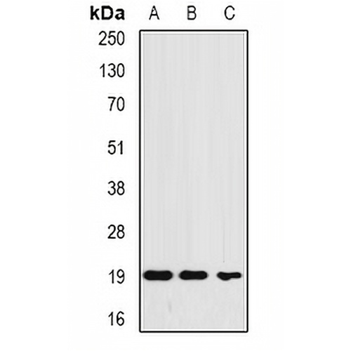Ferritin L Rabbit Polyclonal Antibody