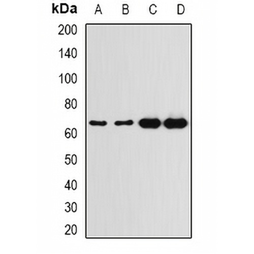 G6PD Rabbit Polyclonal Antibody
