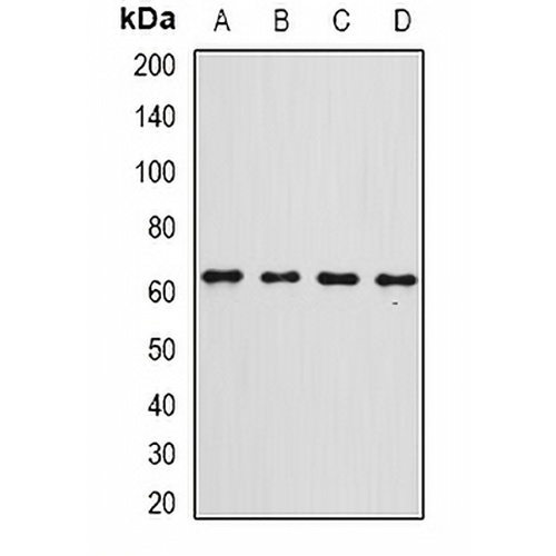 Gc-globulin Rabbit Polyclonal Antibody