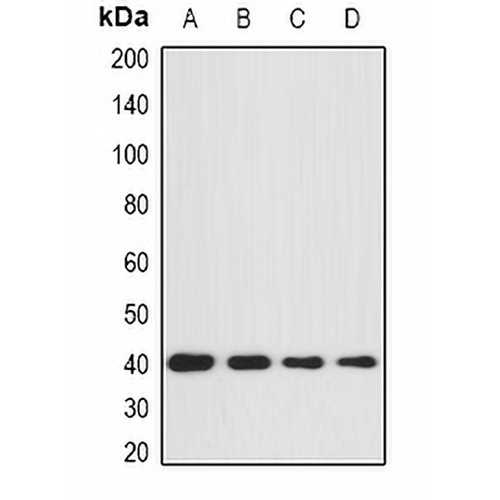 GNA11 Rabbit Polyclonal Antibody