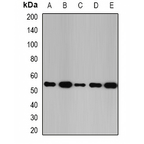 Glutathione Synthetase Rabbit Polyclonal Antibody