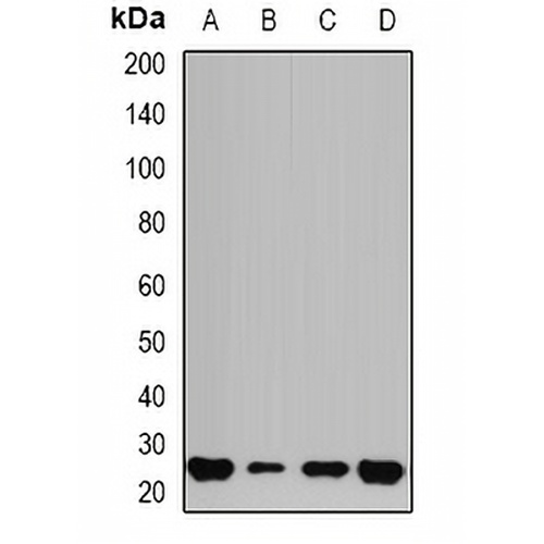 GSTP1 Rabbit Polyclonal Antibody