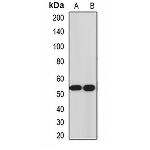 Hemojuvelin Rabbit Polyclonal Antibody