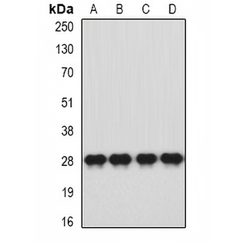 HLA-DQA1 Rabbit Polyclonal Antibody
