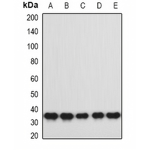 hnRNP A0 Rabbit Polyclonal Antibody