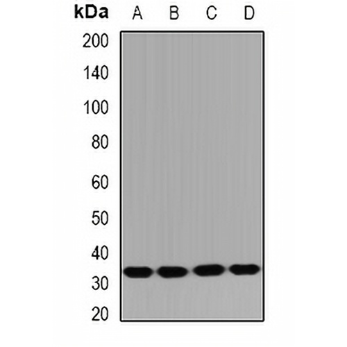 HUS1B Rabbit Polyclonal Antibody