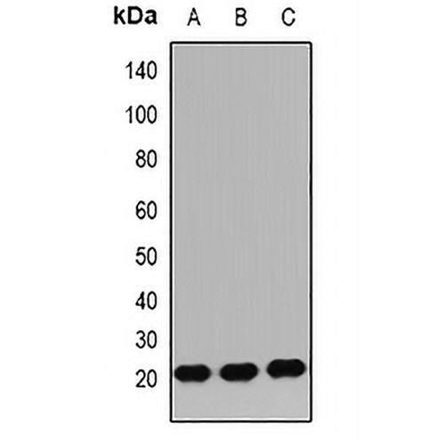 IGF2 Rabbit Polyclonal Antibody