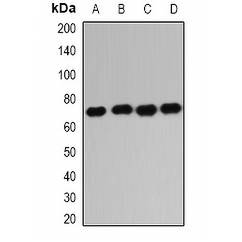 IGF2BP1 Rabbit Polyclonal Antibody